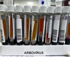 No Paraná, a dengue é diagnosticada de diferentes maneiras: critério clínico epidemiológico, exame laboratorial de sorologia ELISA (Enzyme Linked Immuno Sorbent Assay) e exame de Reação em Cadeia da Polimerase em Tempo Real (RT-qPCR). Diferente da Covid-19, os exames laboratoriais de arboviroses são utilizados para critérios de vigilância em saúde.