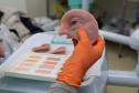 Ambulatório de próteses faciais reconstrutivas do Hospital de Reabilitação do Paraná