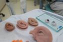 Ambulatório de próteses faciais reconstrutivas do Hospital de Reabilitação do Paraná