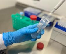 Governo apoia pesquisa em genética com foco na prevenção de doenças na população