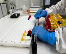No Paraná, a dengue é diagnosticada de diferentes maneiras: critério clínico epidemiológico, exame laboratorial de sorologia ELISA (Enzyme Linked Immuno Sorbent Assay) e exame de Reação em Cadeia da Polimerase em Tempo Real (RT-qPCR). Diferente da Covid-19, os exames laboratoriais de arboviroses são utilizados para critérios de vigilância em saúde.