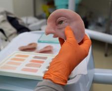 Ambulatório de próteses faciais reconstrutivas do Hospital de Reabilitação do Paraná