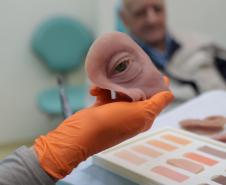 Ambulatório de próteses faciais reconstrutivas do Hospital de Reabilitação do Paraná