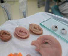 Ambulatório de próteses faciais reconstrutivas do Hospital de Reabilitação do Paraná