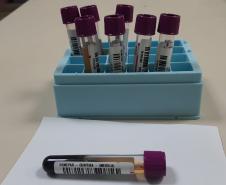 Solidariedade: Paraná tem o 3º maior cadastro de doadores de medula óssea do Brasil