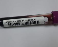 Fevereiro Laranja: a luta contra a leucemia e a importância do diagnóstico precoce