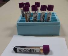 Fevereiro Laranja: a luta contra a leucemia e a importância do diagnóstico precoce