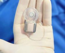 Paraná assume liderança nacional em implantes cocleares pelo SUS