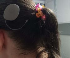 Paraná assume liderança nacional em implantes cocleares pelo SUS