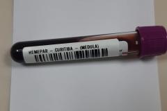 Fevereiro Laranja: a luta contra a leucemia e a importância do diagnóstico precoce