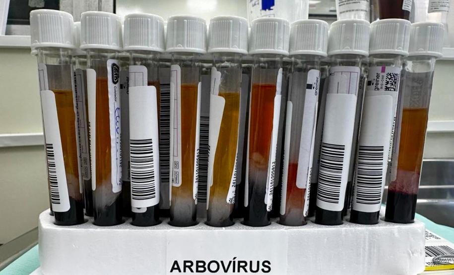 No Paraná, a dengue é diagnosticada de diferentes maneiras: critério clínico epidemiológico, exame laboratorial de sorologia ELISA (Enzyme Linked Immuno Sorbent Assay) e exame de Reação em Cadeia da Polimerase em Tempo Real (RT-qPCR). Diferente da Covid-19, os exames laboratoriais de arboviroses são utilizados para critérios de vigilância em saúde.