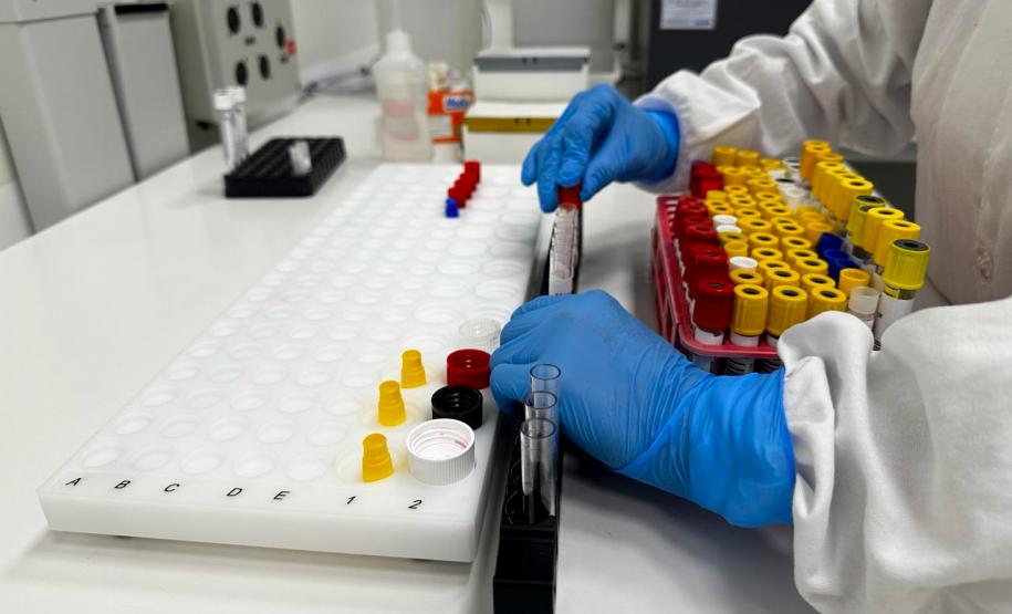 No Paraná, a dengue é diagnosticada de diferentes maneiras: critério clínico epidemiológico, exame laboratorial de sorologia ELISA (Enzyme Linked Immuno Sorbent Assay) e exame de Reação em Cadeia da Polimerase em Tempo Real (RT-qPCR). Diferente da Covid-19, os exames laboratoriais de arboviroses são utilizados para critérios de vigilância em saúde.