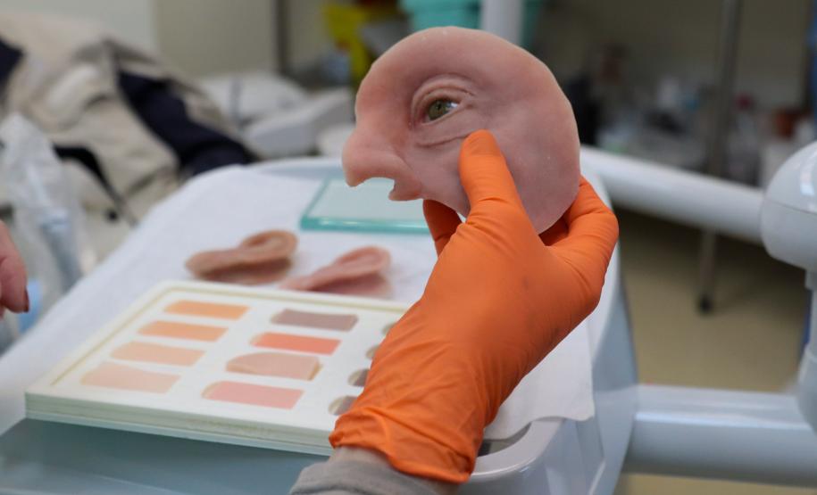 Ambulatório de próteses faciais reconstrutivas do Hospital de Reabilitação do Paraná