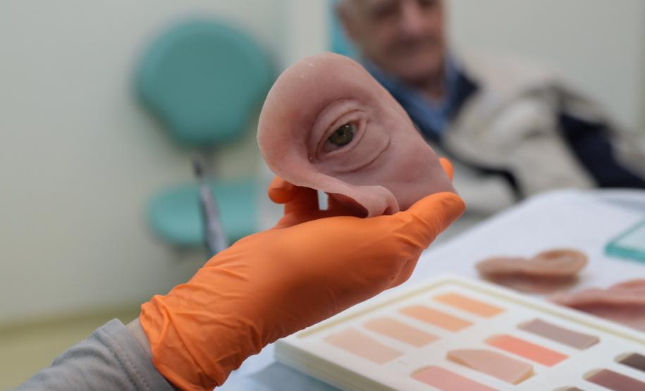 Ambulatório de próteses faciais reconstrutivas do Hospital de Reabilitação do Paraná