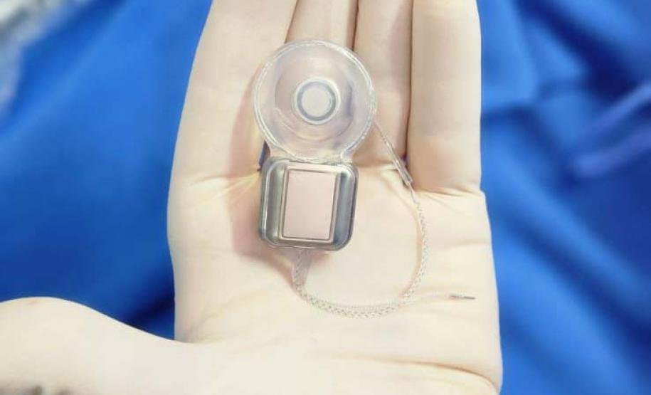 Paraná assume liderança nacional em implantes cocleares pelo SUS