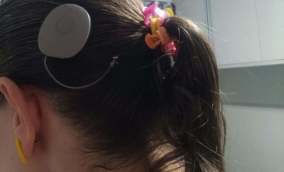 Paraná assume liderança nacional em implantes cocleares pelo SUS